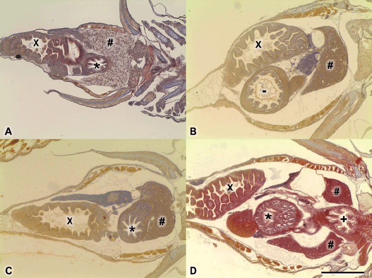 pylorus