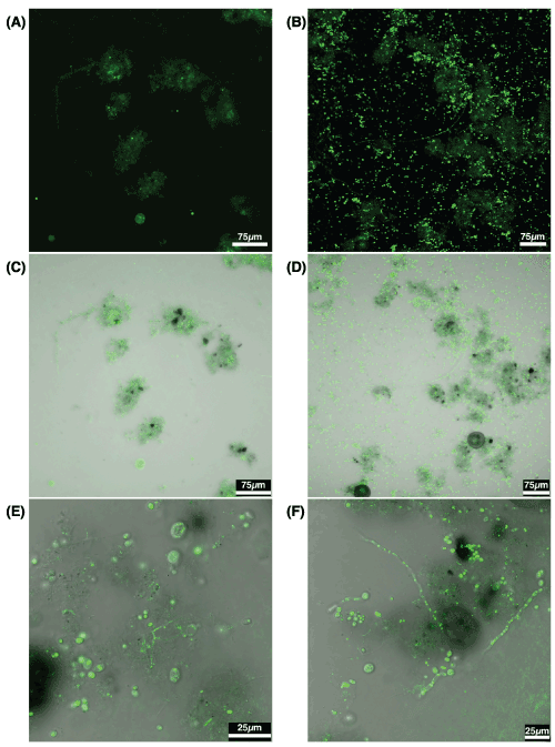 Confocal