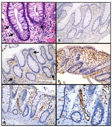 Colonic