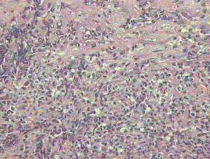 Histological