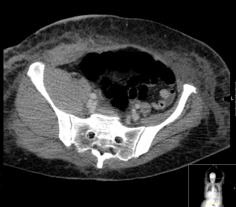 Diagnostic