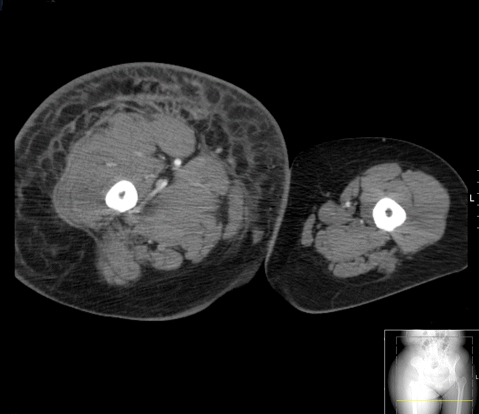 Diagnostic