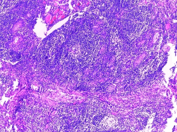 Pathological