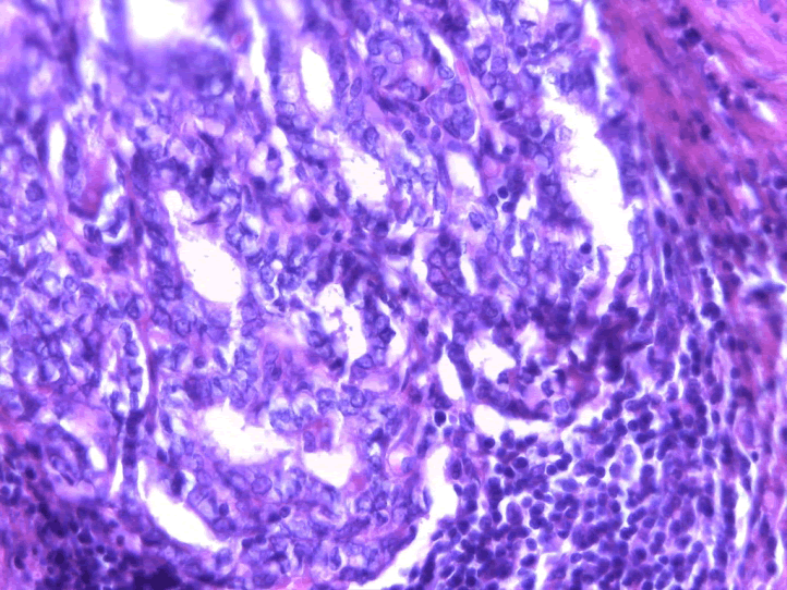 Pathological