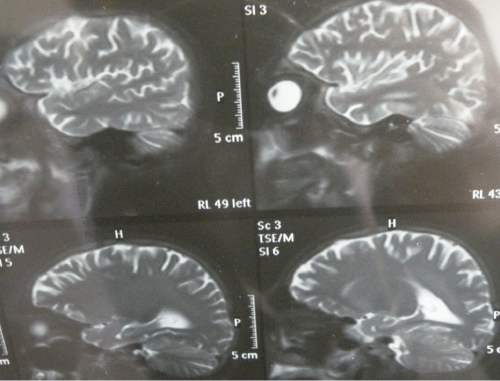 Cranial