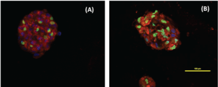 confocal