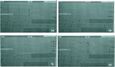 Holter