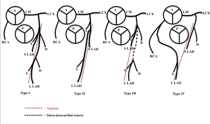 circulation