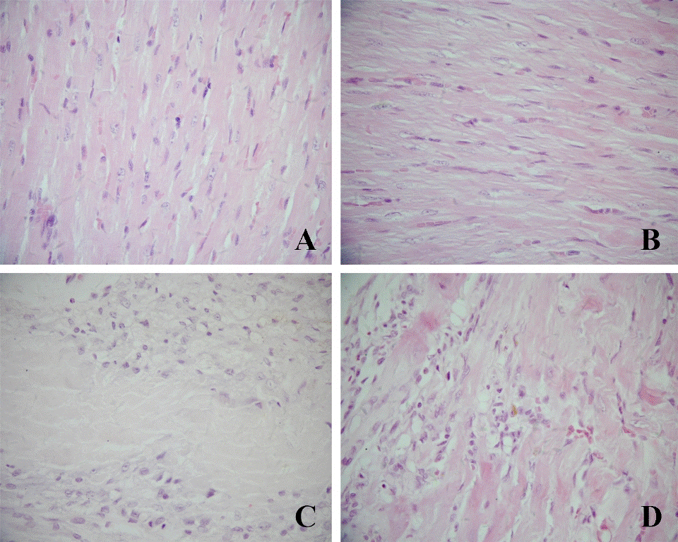 myocardium