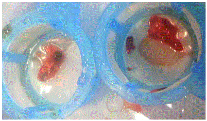 Photograph showing the clots