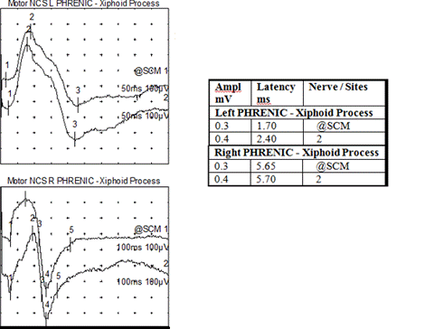 Electrophysiological