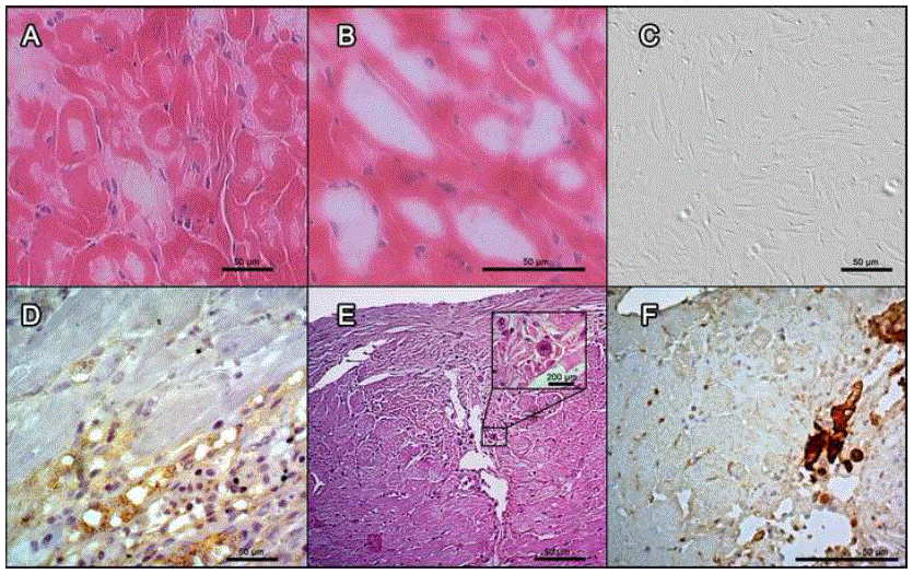 Coculture of MSCs