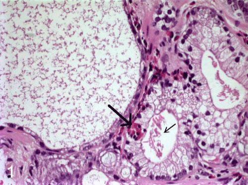 Photomicrograph