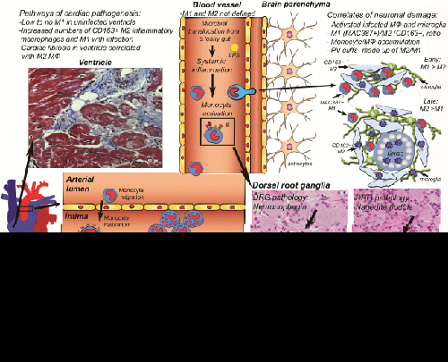 macrophages