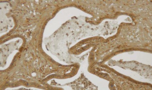 monoclonal