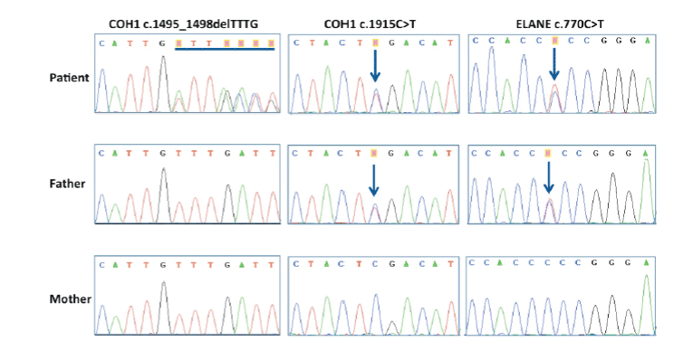 Sequencing