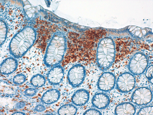Immunohistochemical