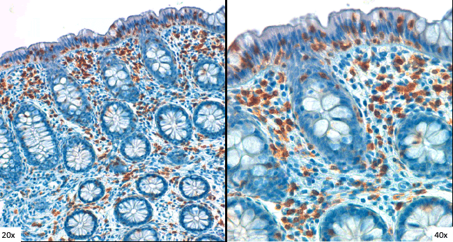 Immunohistochemical