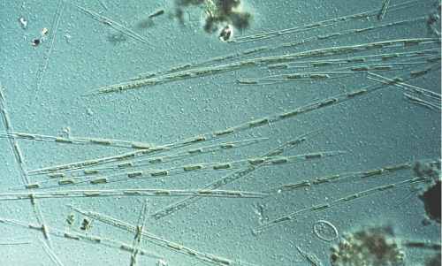 Photomicrograph