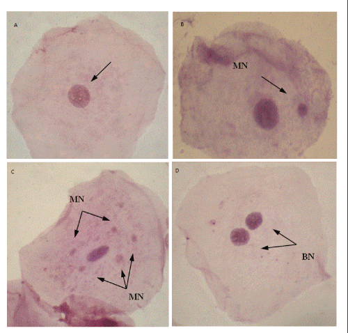 epithelial