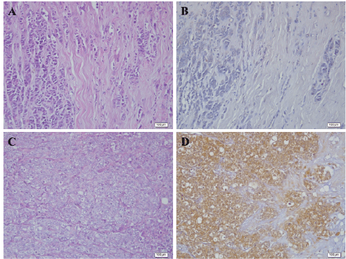 Hematoxylin