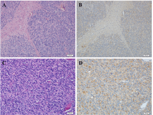 Hematoxylin