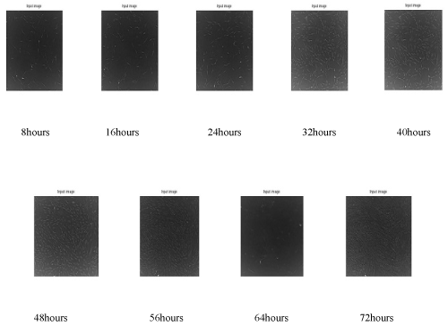 filtering