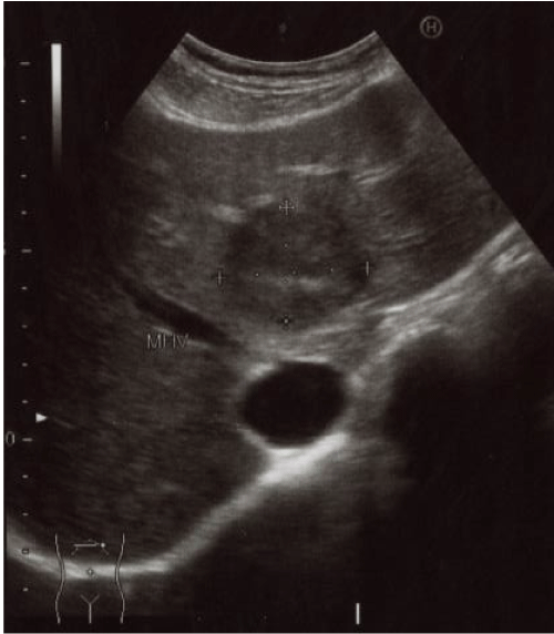 sonography
