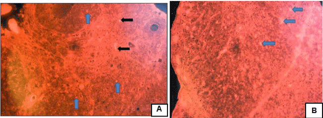 photomicrograph