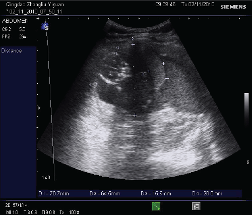 Abdominal