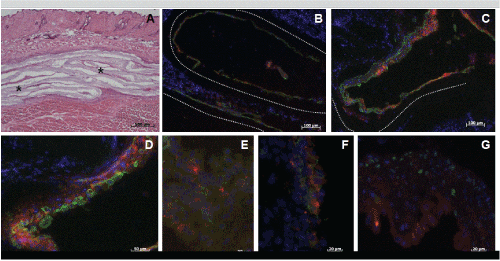 Immunofluorescence