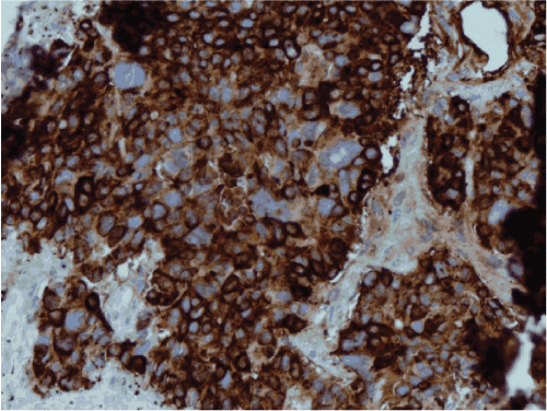 Chromogranin