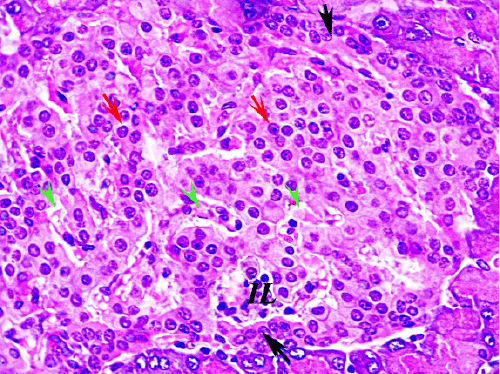 pancreas