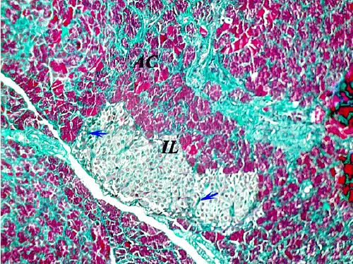 pancreas