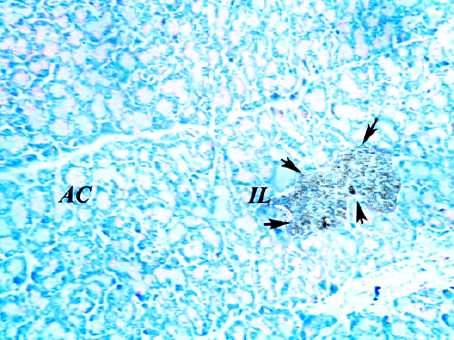 pancreas