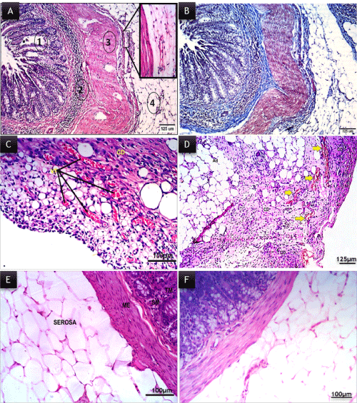 macroscopically