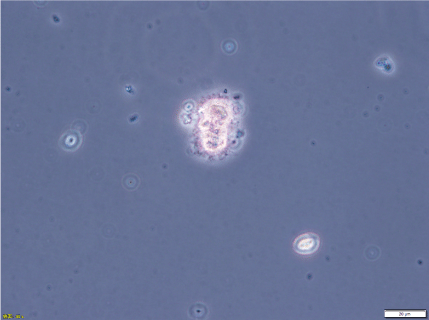 microscopic