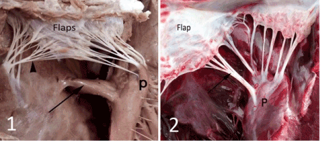 plate 1 chordae tendineae