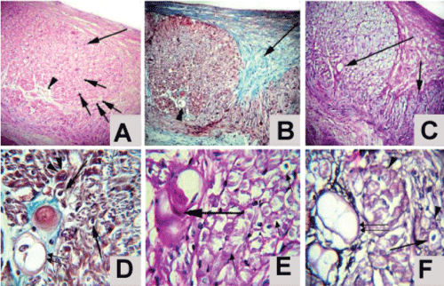 photomicrograph