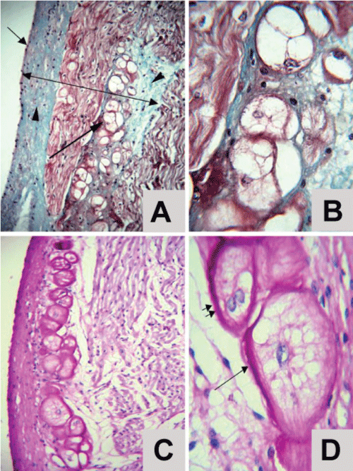 photomicrograph of