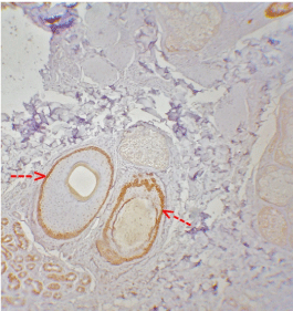 CK15