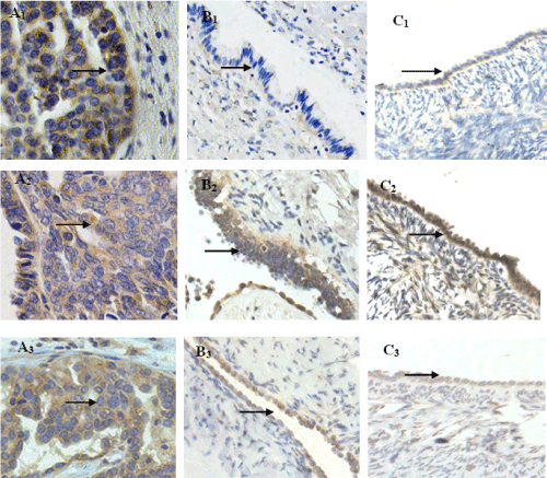 Immunohistochemical