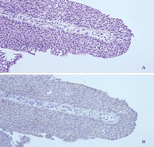 urothelial