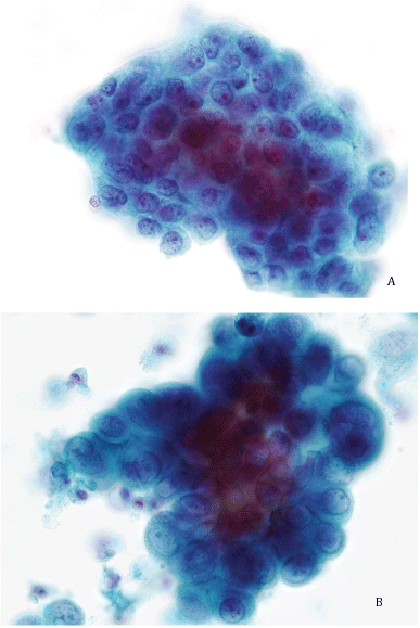 Cytopathological