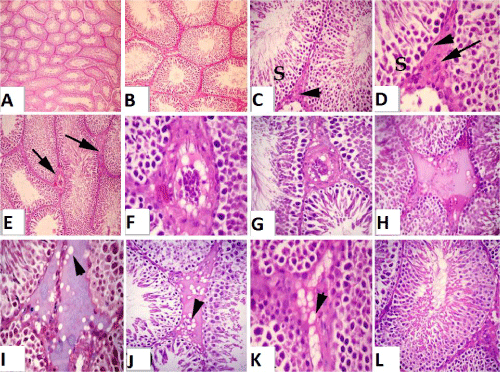 testis