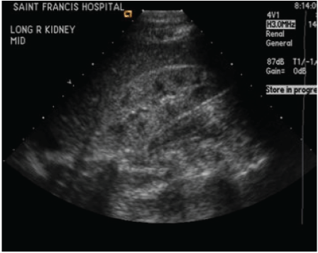 Ultrasound