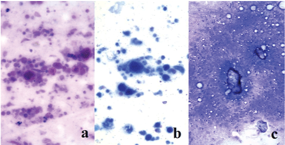 epithelial