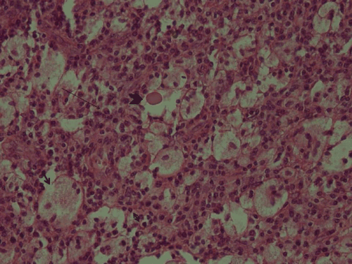 Microscopy