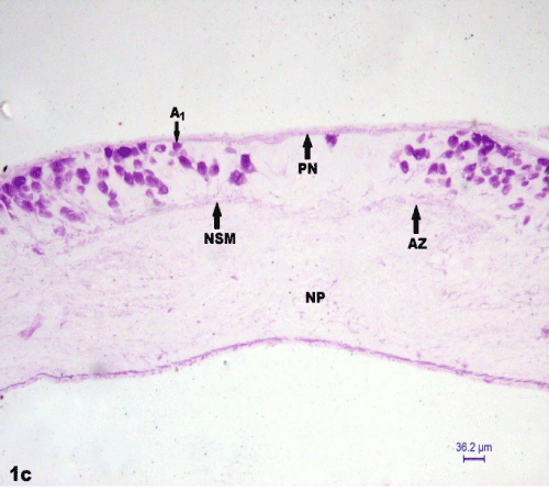 distribution