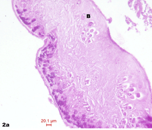 distribution